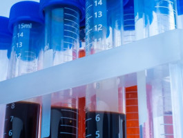 Mehrere Laborröhrchen mit Blutproben in einer Halterung.