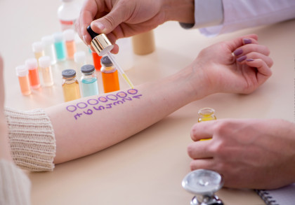 Ein Arm, auf dem mehrere Kreise mit einer lila Markierung gezeichnet sind, wird von einer Person gehalten. Eine andere Person trägt mit einer Pipette eine Flüssigkeit in einen der Kreise auf.