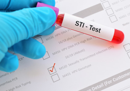 Eine Hand mit einem blauen Handschuh hält ein Reagenzglas mit Blutprobe, das mit „STI-Test“ beschriftet ist. Im Hintergrund ist ein Formular mit verschiedenen Testoptionen zu sehen, von denen eine mit einem roten Häkchen markiert ist.