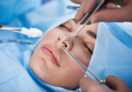 Nahaufnahme einer Person während einer Nasenkorrektur-Operation. Die Person liegt auf einem OP-Tisch, teilweise bedeckt mit blauen chirurgischen Tüchern. Ärzte verwenden verschiedene medizinische Instrumente, um den Eingriff durchzuführen.