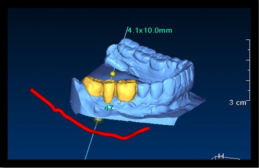 3D-Bilder und spezielle Computersoftware bieten viele Möglichkeiten für die Implantologie (c) Dr. Novakovic