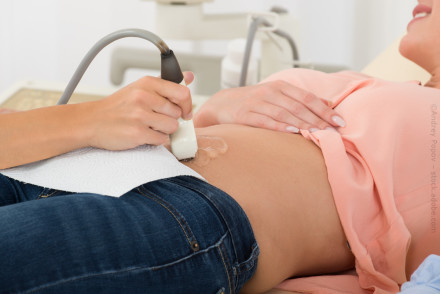 Eine Person erhält eine Ultraschalluntersuchung am Bauch. Die Hand eines medizinischen Fachpersonals hält den Ultraschallkopf und bewegt ihn über den Bauch der liegenden Person. Der Bauch ist teilweise mit Gel bedeckt.
