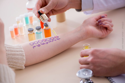 Ein Arm, auf dem mehrere Kreise mit einer lila Markierung gezeichnet sind, wird von einer Person gehalten. Eine andere Person trägt mit einer Pipette eine Flüssigkeit in einen der Kreise auf.