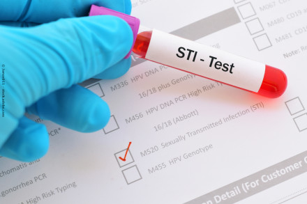Eine Hand mit einem blauen Handschuh hält ein Reagenzglas mit Blutprobe, das mit „STI-Test“ beschriftet ist. Im Hintergrund ist ein Formular mit verschiedenen Testoptionen zu sehen, von denen eine mit einem roten Häkchen markiert ist.