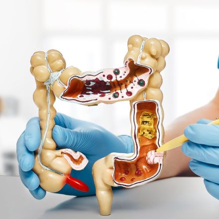 Eine Person mit blauen Handschuhen hält ein Modell des menschlichen Dickdarms, das anatomische Details wie den Inneren und Äußeren Aufbau des Darms zeigt.