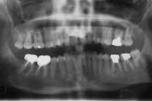 00001 1 vvio85 - Eugenol
