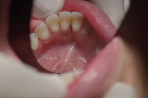 001 nycitm - Eugenol