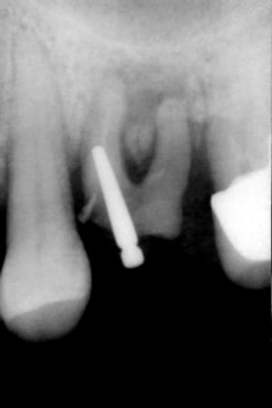 003 auu8yd - Eugenol
