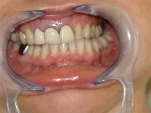 004 tojmf4 - Eugenol