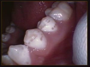 008 u2xofs - Eugenol