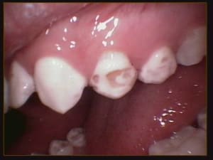 009 uihbec - Eugenol