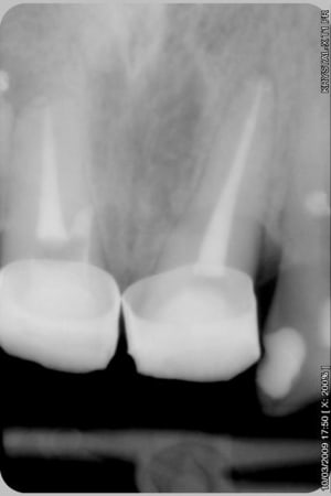 010 vm38xo - Eugenol