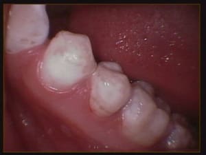 012 vrj61o - Eugenol