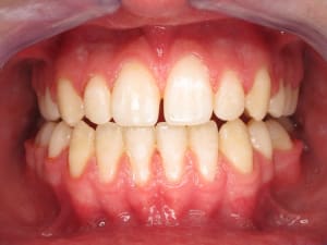 01353725 bzkuhd - Eugenol