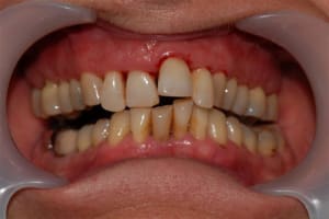 017 omw02l - Eugenol