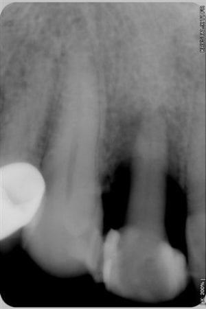 039 bbdkik - Eugenol