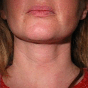 03 repos egurne - Eugenol