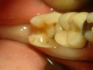 04051512 ugeolt - Eugenol