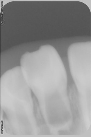 046 cbih4y - Eugenol