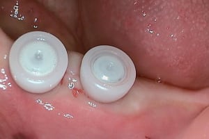 05 20120324 120114 czprup - Eugenol