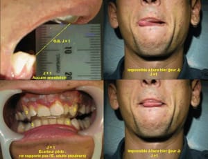 051018 tr01 phpcrv - Eugenol