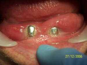 100 1207 zyoy04 - Eugenol