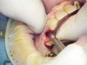 100 7764 zjgdqa - Eugenol
