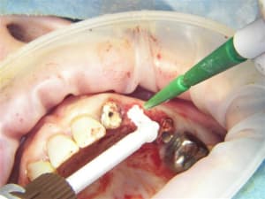 100 7808 gl0tki - Eugenol