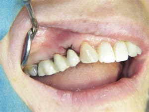 100 7813 cpokrq - Eugenol