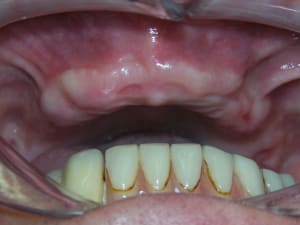 100 9485 nxiqap - Eugenol