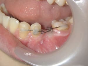 10882 4bis ilffm8 - Eugenol