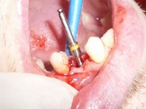 11 js97rd - Eugenol