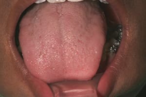 131 ckomz7 - Eugenol