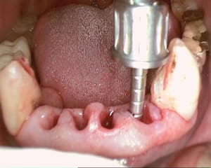 14 20120602 094149 fuymwi - Eugenol
