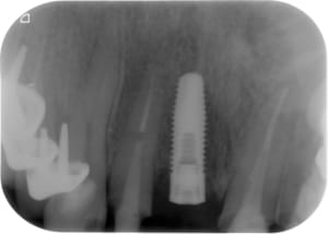 14032011  xlzlca - Eugenol