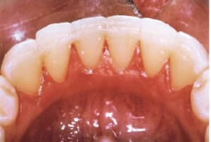 1 ejxork - Eugenol