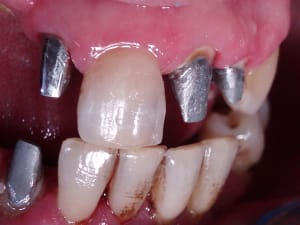 1 qrrefq - Eugenol