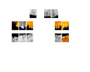 1 si6mm7 - Eugenol