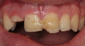 1ere consult xbm9b2 - Eugenol