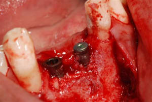 2007 06 23 011 vk30uc - Eugenol