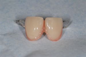 2008 01 25 017 sxhf5j - Eugenol