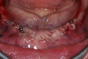2008 06 28 011 r2zvfr - Eugenol