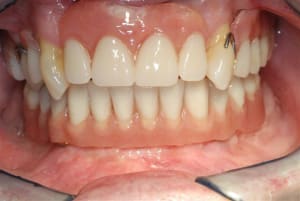 2008 11 14 016 nekn48 - Eugenol