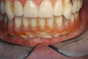 2009 03 16 013 djhbgc - Eugenol