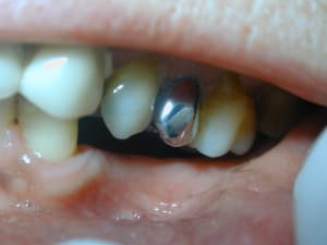 2009 11 27 3 crlrnf - Eugenol