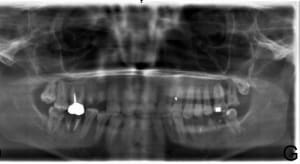 2017 06 02 dgmhi6 - Eugenol