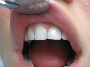 21apres s40fag - Eugenol