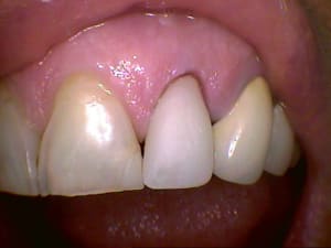 22 multi usinee - Eugenol