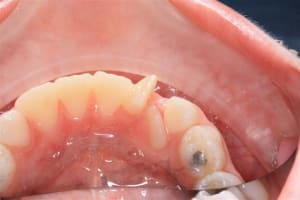 24022010 laterale supplementaire 002  small  tffpsn - Eugenol