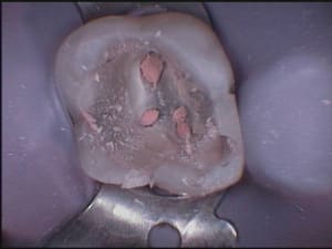 26 condensation terminée c7nwt7 - Eugenol